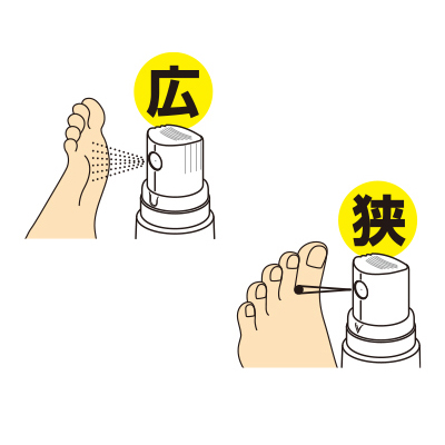 [hisamitsu] 부테나로크 V알파(무좀)액상스프레이 20ml